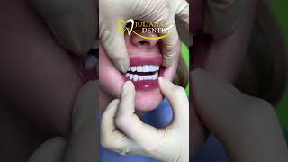 Яскрава робота лікаря Юлії Ковальської ✅ #dentist #dentalclinic #dnipro #ukraine
