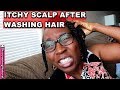 Itchy Scalp After Washing Natural Hair