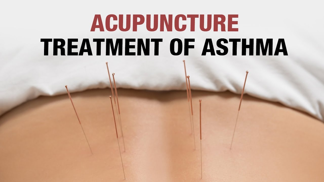 Acupuncture Treatment of Asthma Dr. Mayie Deshmukh Holistic