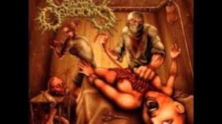 Cranial Osteotomy - Victim Of Wicked Sickness