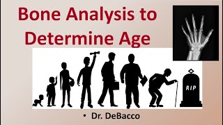 Bone Analysis to Determine Age