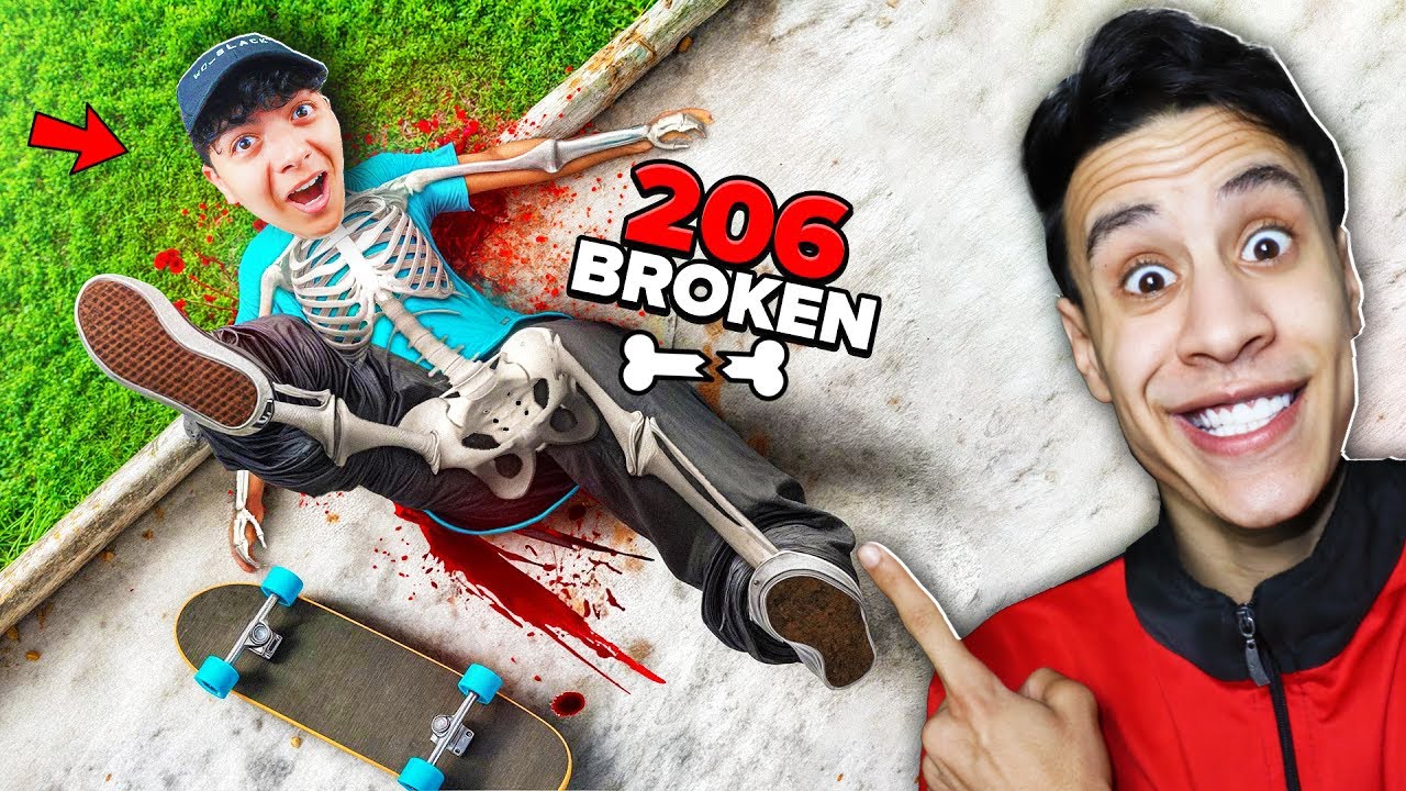 تحدي تكسير العظام الي يكسر عظمة اكثر يفوز ام كامل وسحس الفأر🦴😂 - Skate