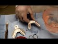 Lower primary impression making for completely edentulous patient utilizing impression compound