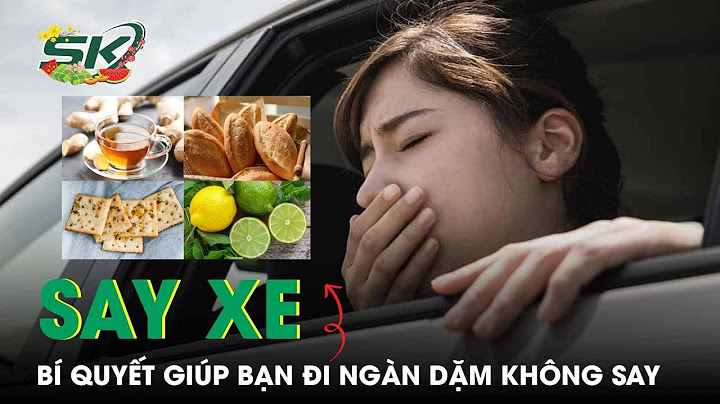 Bị say xe làm kiểm toán được không năm 2024