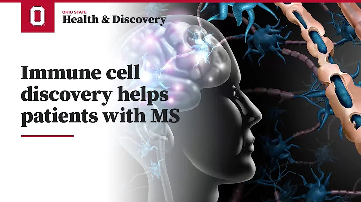 Immune cell discovery helps patients with MS | Ohio State Medical Center