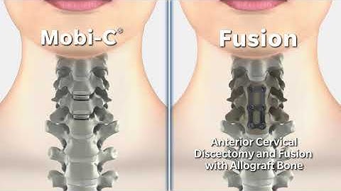Mobi C vs  Fusion Animation Video full file
