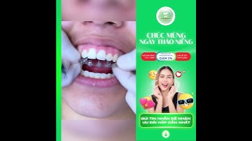 Tháo niềng răng sau 1.5 năm niềng