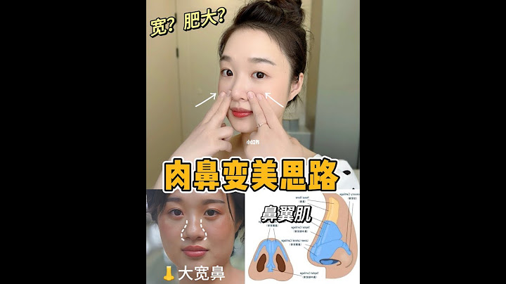 肉鼻女孩的痛谁能懂！鼻子变美思路
