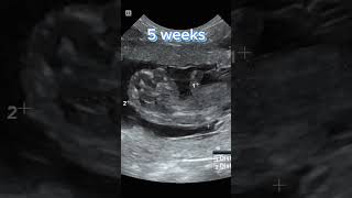 Dog PREGNANCY weekly ULTRASOUNDS: Part 1