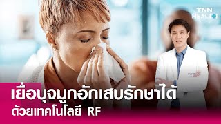 ภูมิแพ้เยื่อจมูกอักเสบ รักษาได้ ด้วยเทคโนโลยี RF | โรงพยาบาลเวชธานี