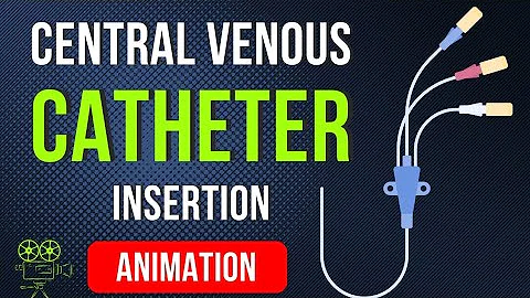 🎬 CENTRAL VENOUS CATHETER (CVC) INSERTION PROCEDURE | ANIMATED EXPLANATION