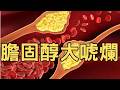 🔴EP175.五桶哪國?刪手足特留分、新冠又竄起、熊本強震、美伊恢復轟炸、民調僅33趴、膽固醇大唬爛、發明(壞)脂肪、FED不升息喊鷹、美股大跌台股失守4萬、油價急升毒油獨漲、輝達循環融資