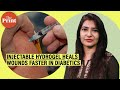 Institute of Nano Science and Technology creates injectable hydrogel that heals wounds in diabetics