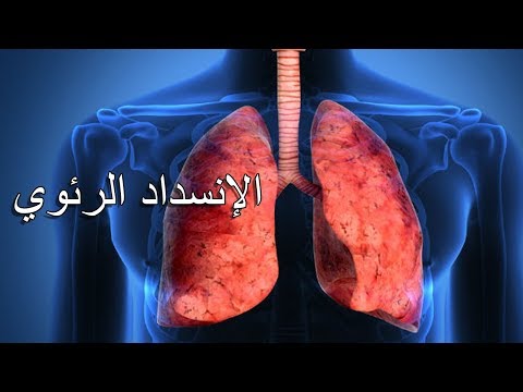 5- الإنسداد الرئوي : الأعراض وكيفية الوقاية وطرق العلاج (من اضرار التدخين)