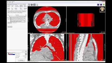 AnalyzePro: Multiple Object Segmentation