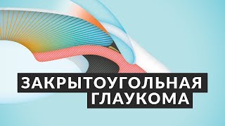 👁️ ОТ ЭТОГО МОЖНО ОСЛЕПНУТЬ! 👁️ Закрытоугольная глаукома: симптомы, причины, лечение Доктор Лапочкин