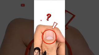 What Your Nails Say About Your Health? |#shorts #facts #shortsfeed