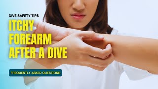 Famous FAQ Itchy skin after diving Net Worth