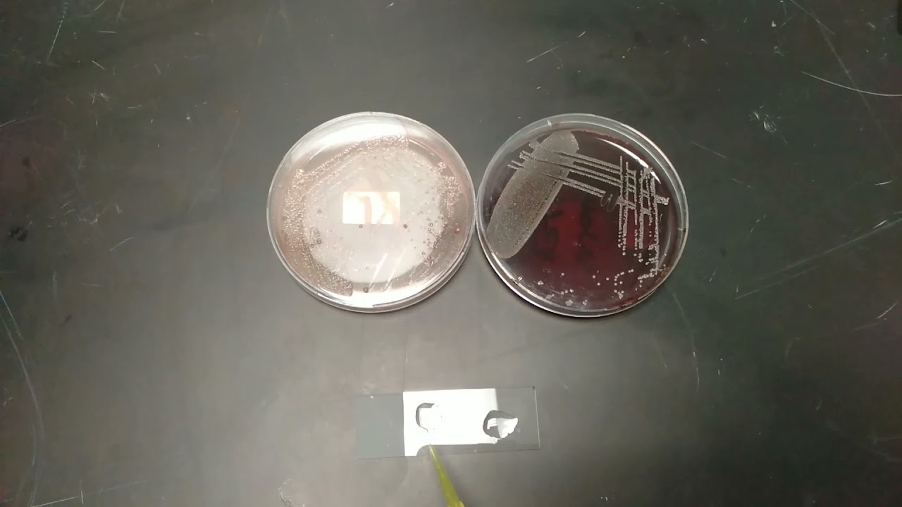 Koh string test youtube