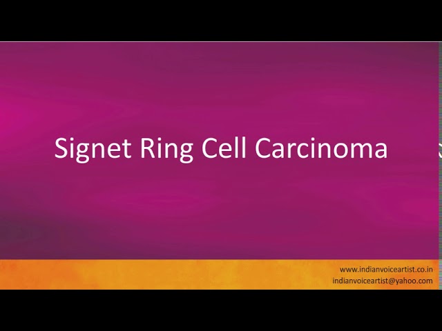 Single-cell analysis of gastric signet ring cell carcinoma reveals  cytological and immune microenvironment features | Nature Communications