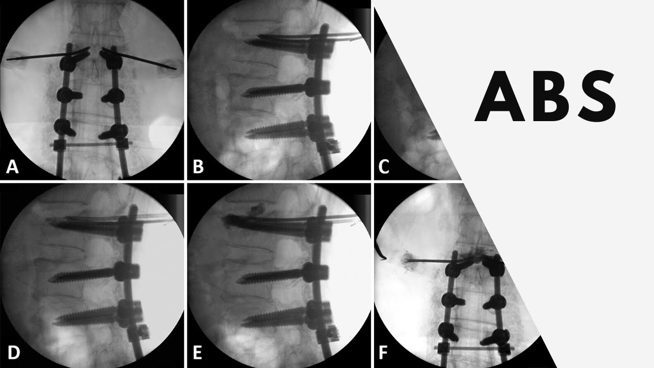 Automatic Stabilization of Brightness YouTube