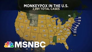 Monkey Pox; What We Learned From Covid-19 And How the U.S. Response Should be Better | Symone