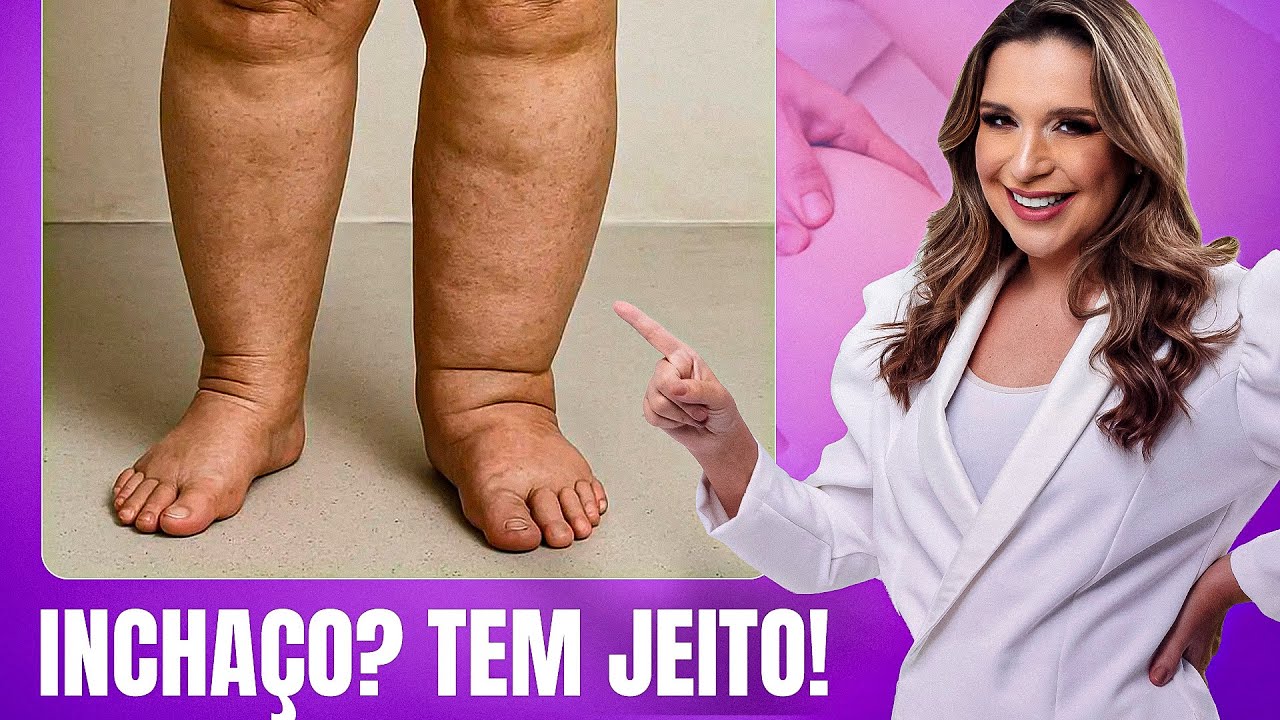 Linfedema: Como Aliviar o Inchaço