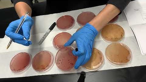 PARE - Counting Colonies