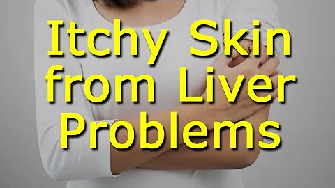 Itchy Skin from Liver Problems - DayDayNews