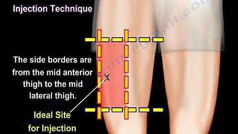 Vastus Lateralis Intramuscular Injection - Everything You Need To Know - Dr. Nabil Ebraheim
