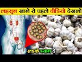 लड़के जरूर देखे | कच्चा लहसुन खाने के फ़ायदे ! Raw garlic benefits ! lehsun ! garlic benefits