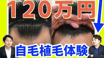 自毛植毛 Youtube