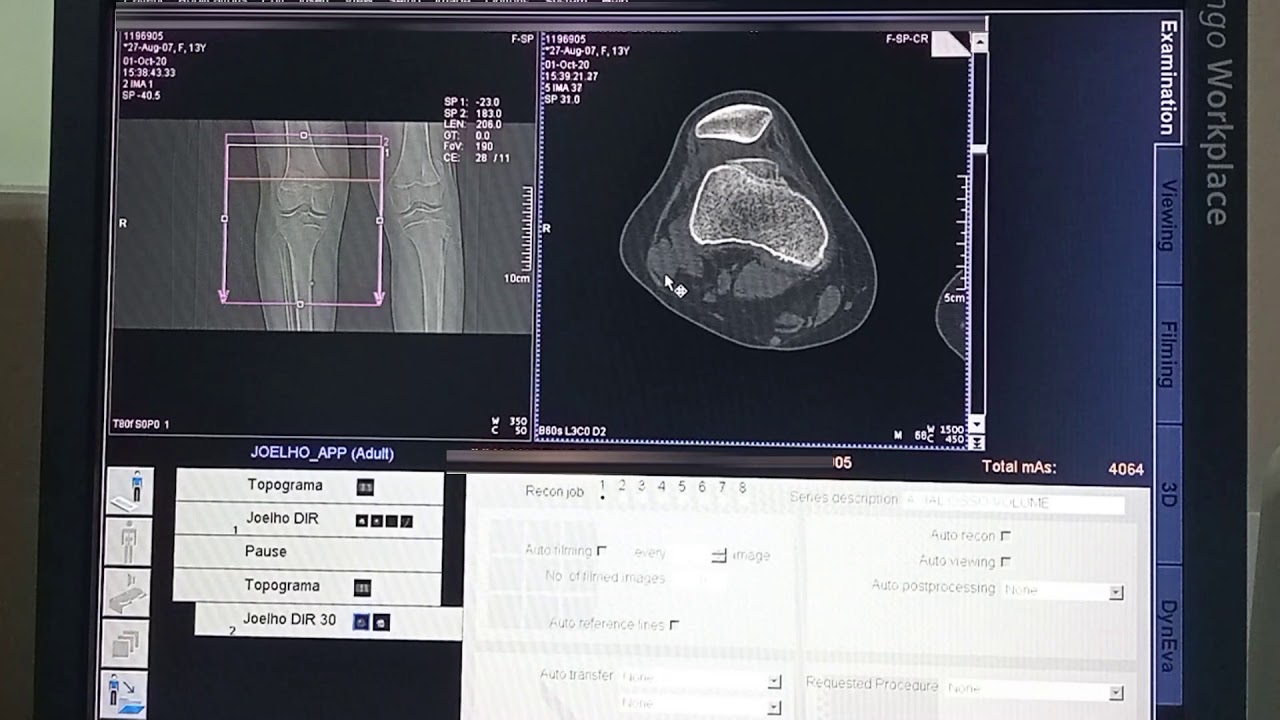 TOMOGRAFIA TA-GT - PROF DIEGO CESAR