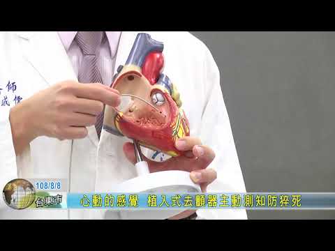 20190808 心動的感覺 植入式去顫器主動測知防猝死