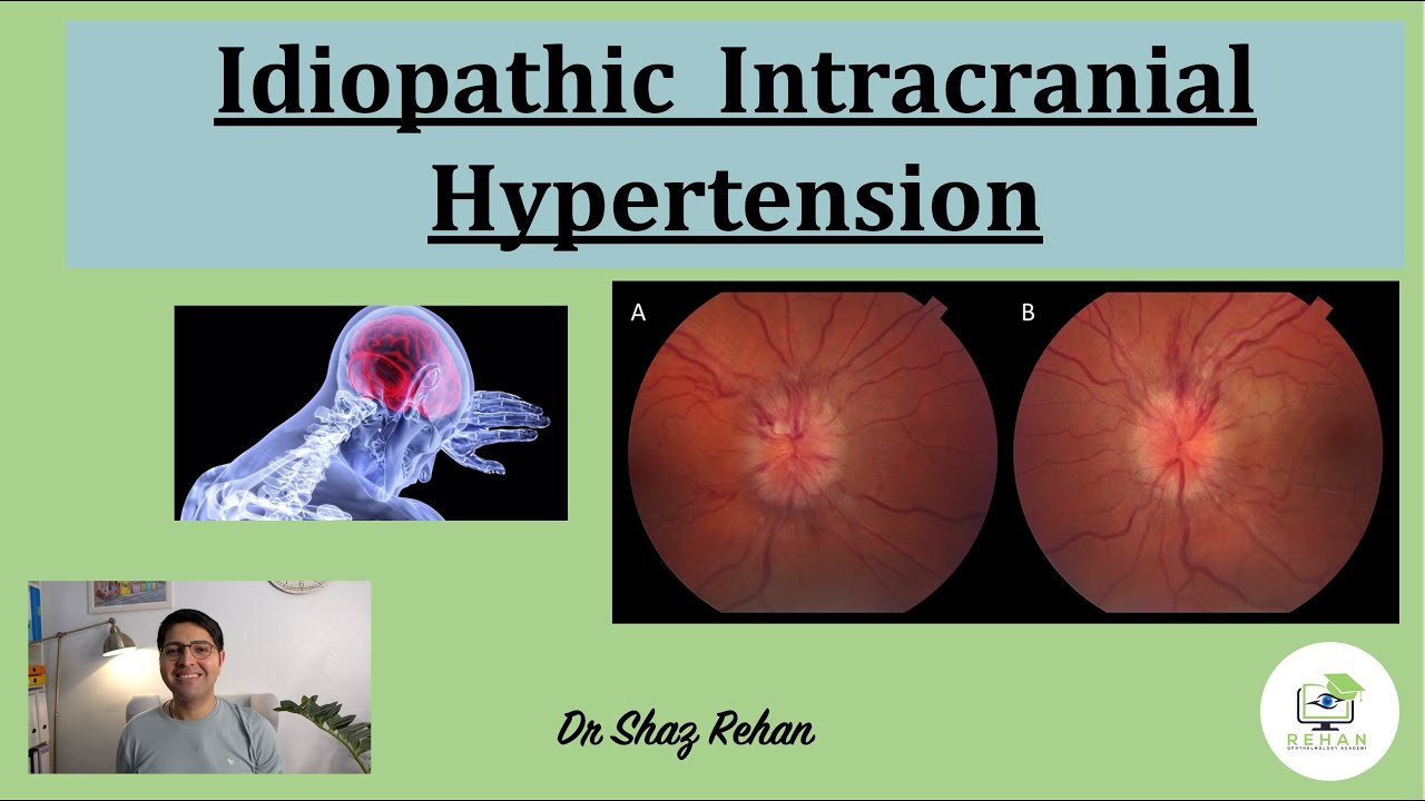 presentation of idiopathic intracranial hypertension