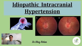 Idiopathic Intracranial Hypertension: What is it? How is it Diagnosed? How is it Treated? I Rehan 21