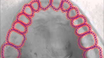Dentition recognition using active shape model