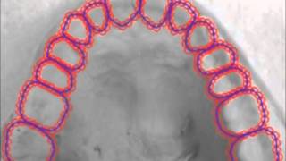 Dentition recognition using active shape model