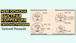 Чем опасна быстрая коррекция гипонатриемии