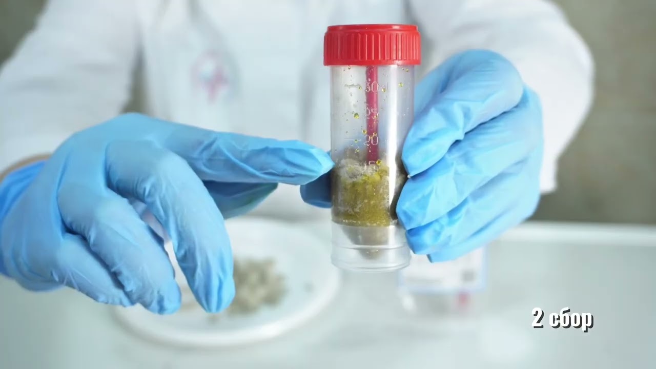 ПРАВИЛА СБОРА АНАЛИЗА КАЛА НА ЯЙЦА ГЕЛЬМИНТОВ И ЦИСТЫ ПРОСТЕЙШИХ 