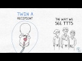 Twin Twin Transfusion presentation Part 1