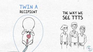 Twin Twin Transfusion presentation Part 1