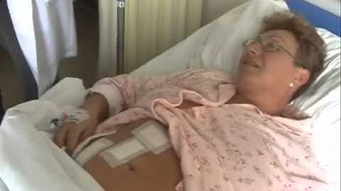 раздвижване на пациет след лапароскопска операция