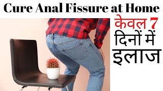 Anal fissure treatment at Home