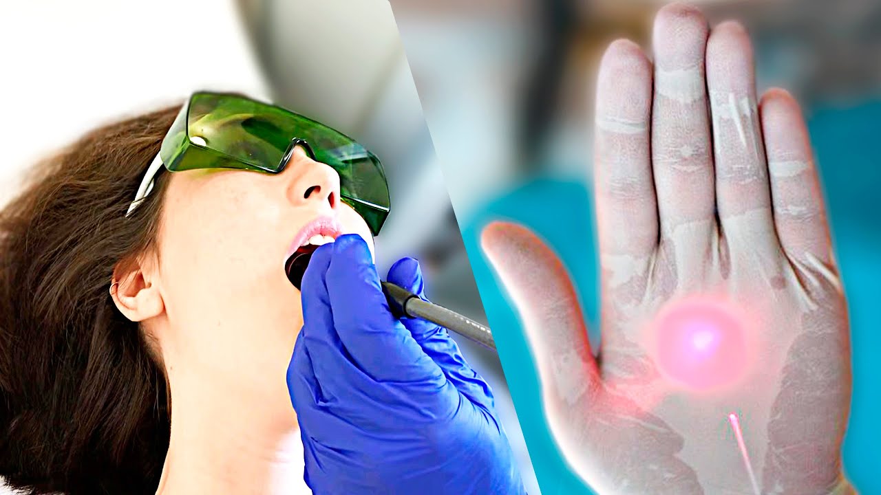 Лечение открытой РАНы во рту при помощи лазера HILT - YouTube