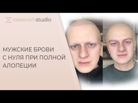 Натуральный перманент бровей для мужчины. Аппаратно волосковый татуаж при алопеции.