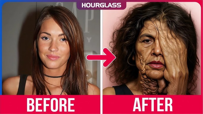 20 Disastrous Plastic Surgeries of Celebrities | Then and Now 2025 - YouTube