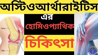 অস্টিও আর্থ্রাইটিসএর হোমিওপ্যাথি ঔষধ | হাড়ের বাতের ব্যাথার হোমিওপ্যাথি মেডিসিন |