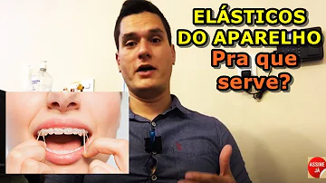Qual cor mais bonita para aparelho Dentario?