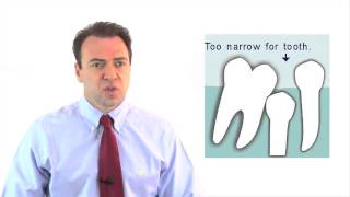 Why are baby teeth important?